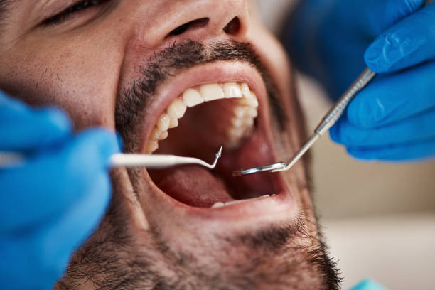 Best Dentist for Dental Trauma  in Garden City, KS